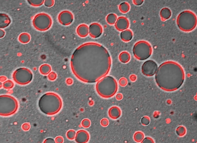 mikroskopický pohled na složení mléka s viditelnými tukovými globulemi